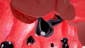 LATEX rubberratory - Page 546