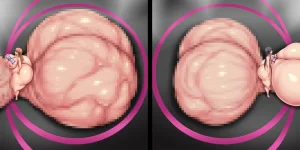 Piyokorota Kai Takkyo-ku Chousa Nisshi 2 Kouhen Portuguese-BR - Page 53